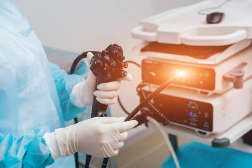 endoscopia