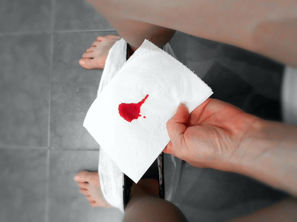 sangue nas fezes